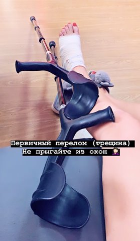 Дробкова сломала ногу