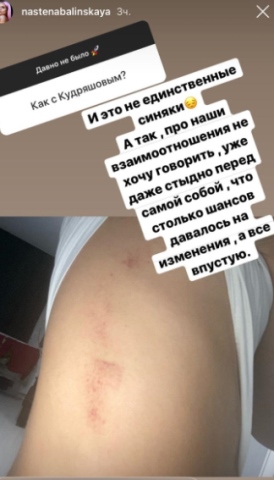 Балинская обещает вернуться на проект