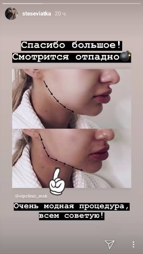 Стецевьят сделала себе новый овал лица