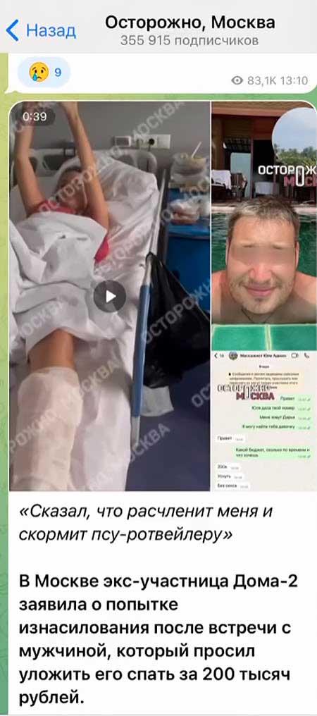 Даша Лымарь, с которой в прошлом Йося изменял Чepнo на острове, в больнице с тяжелыми увечьями