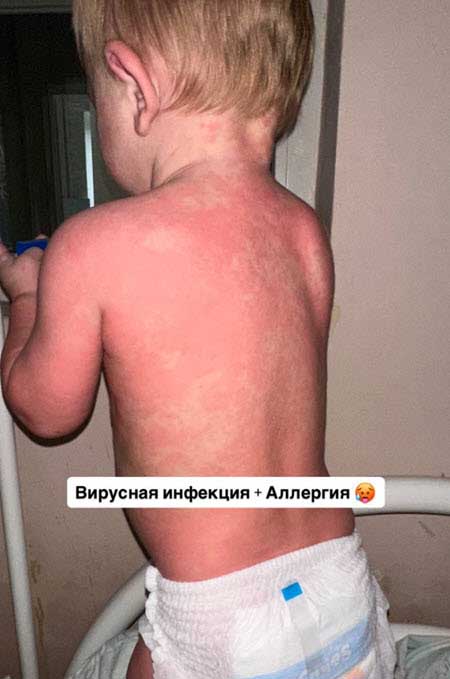 Малышка Анджелина Евстропова попала в больницу