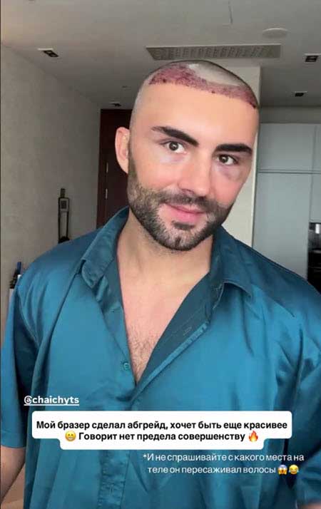 Алексей Чайчиц решил обзавестись новой шевелюрой