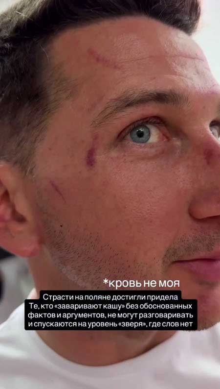 Ссора между Данко и Луковкиным окончилась дракой