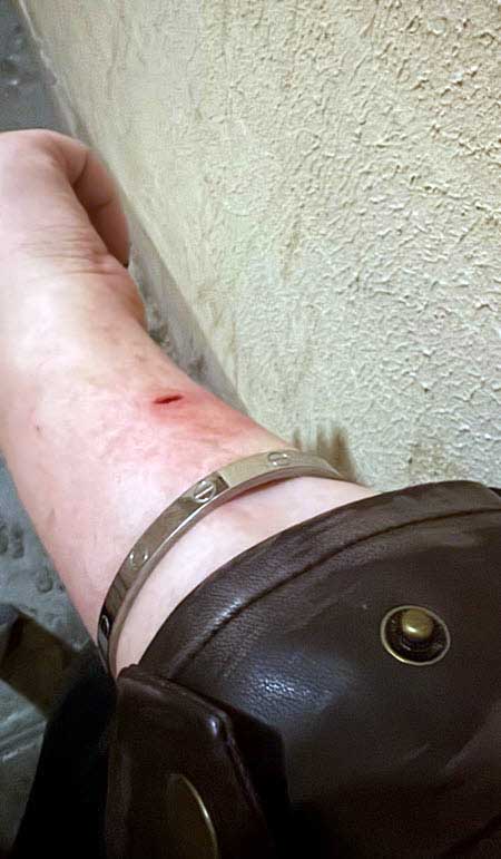 У Саши Чepнo что ни день, то приключенье – бывший возлюбленный чуть не выбросил ее из окна 24 этажа