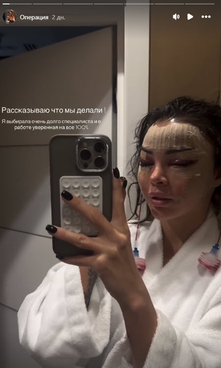 Яна Шафеева и Яна Захарова выглядят после пластики, как персонажи фильма ужасов