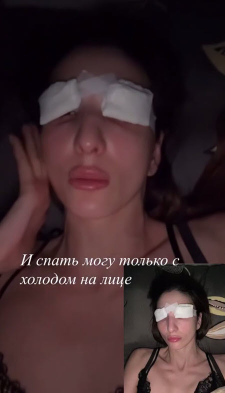 Яна Шафеева и Яна Захарова выглядят после пластики, как персонажи фильма ужасов