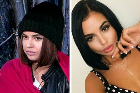 Яна Шафеева и Яна Захарова выглядят после пластики, как персонажи фильма ужасов