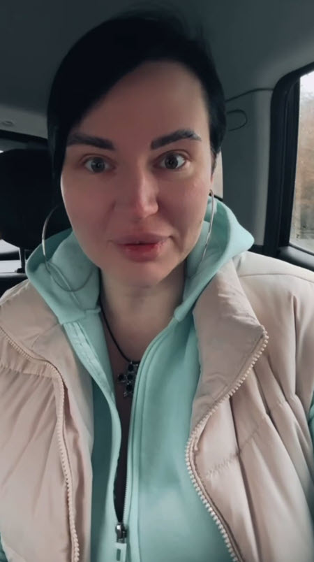 Александре Чepнo сделали дорогой подарок – пластическую операцию