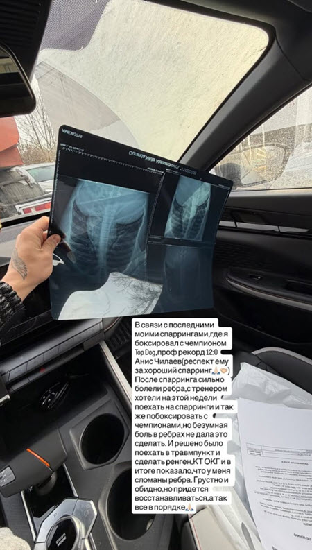 Никита Гуранда получил травму во время боксерского спарринга