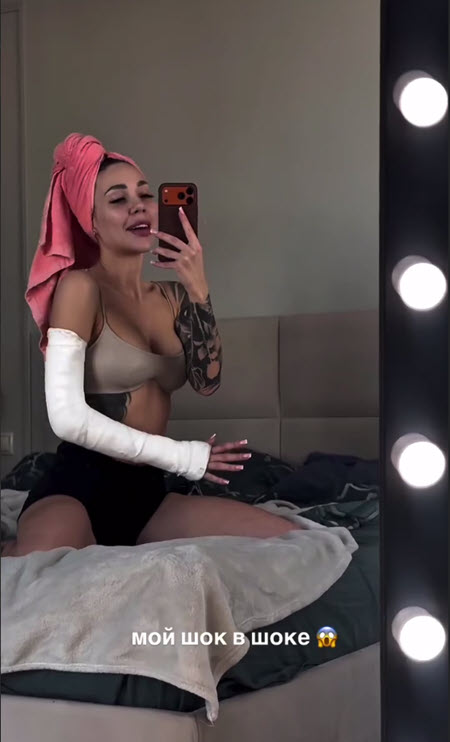 Поездка на Байкал для Алены Савкиной завершилась серьезной травмой