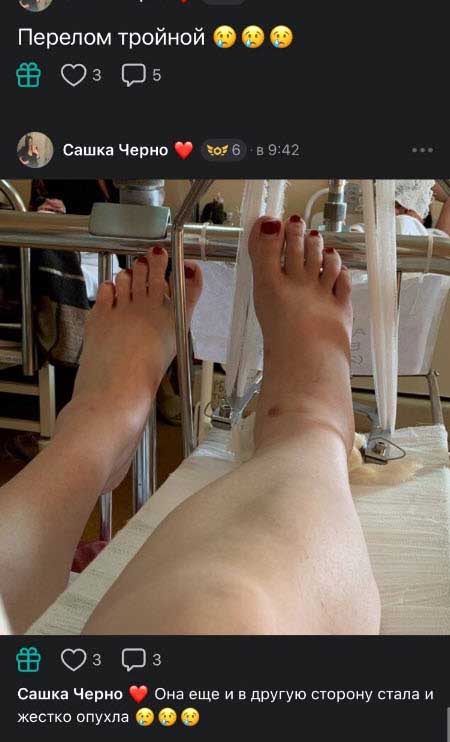 Чepнo вернулась в больницу, с ногой большие проблемы, операция в пятницу