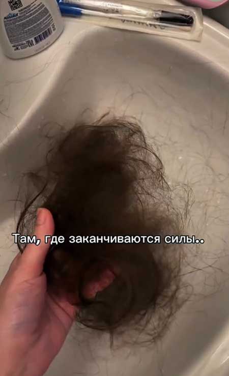 Алена Савкина: «1,5 месяца, как моя земля ушла из-под ног, 1,5 месяца, как я лежу под капельницами»